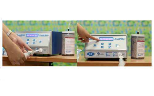Breath Test พ่นลมหายใจ ตรวจภาวะท้องอืดเรื้อรัง