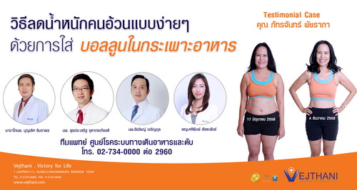 วิธีลดน้ำหนัก คนอ้วนแบบง่ายๆ ด้วยการใส่บอลลูนในกระเพาะอาหาร