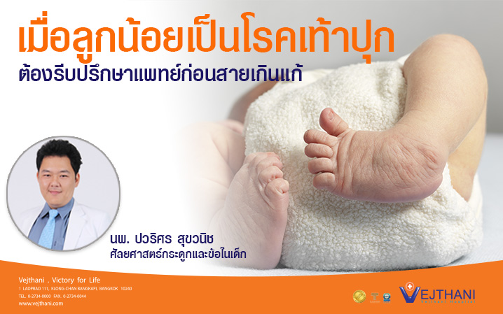 เมื่อลูกน้อยเป็นโรคเท้าปุก...ต้องรีบปรึกษาแพทย์ก่อนสายเกินแก้