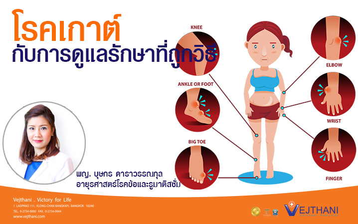 โรคเกาต์กับการดูแลรักษาที่ถูกวิธี