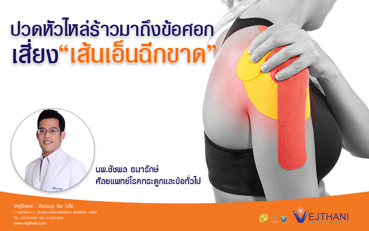 ปวดหัวไหล่ร้าวมาถึงข้อศอก...เสี่ยงเส้นเอ็นฉีกขาด