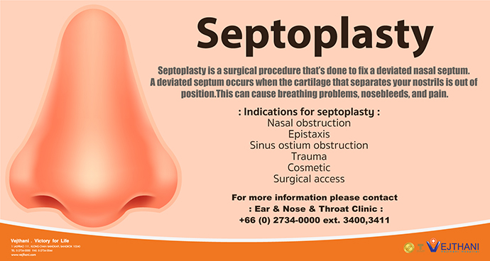 Septoplasty