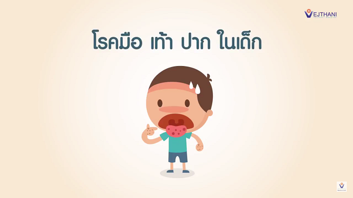 โรคมือ เท้า ปาก ในเด็ก l รพ.เวชธานี