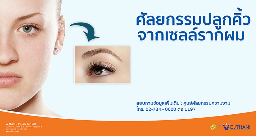 ศัลยกรรมปลูกคิ้วจากเซลล์รากผม