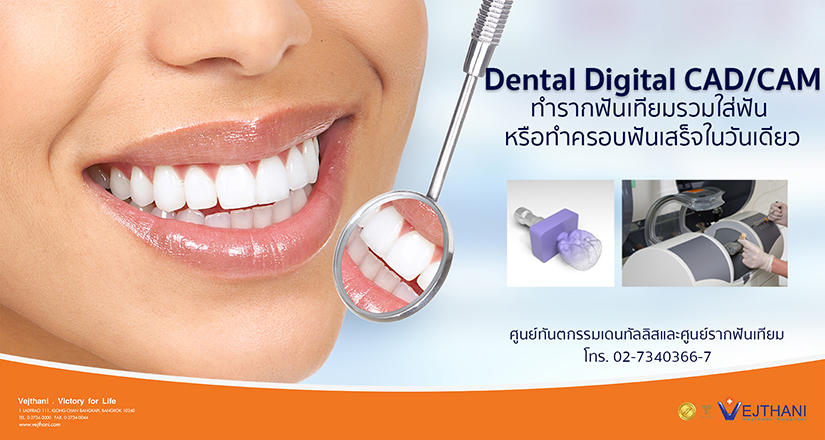 เทคโนโลยี Dental Digital CAD/CAM ทำรากฟันเทียมรวมใส่ฟัน หรือทำครอบฟันเสร็จในวันเดียว