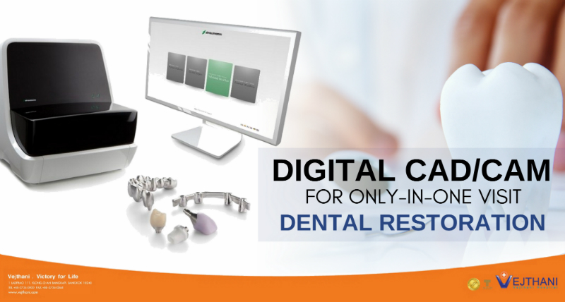 Digital CAD/CAM for Only-In-One Visit Dental Restoration