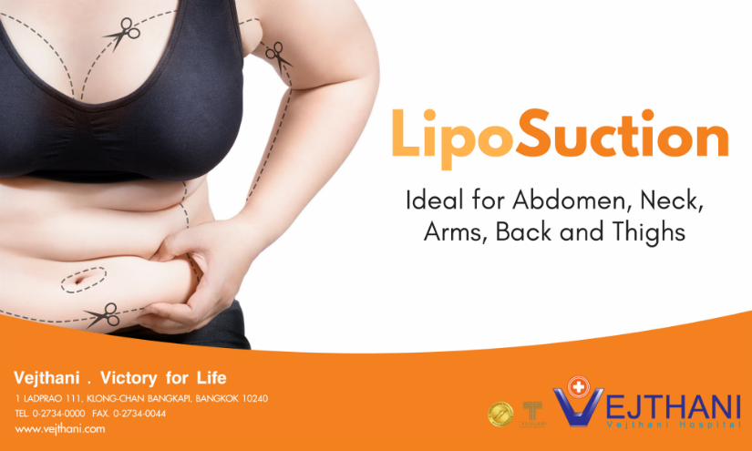 Liposuction in Thailand