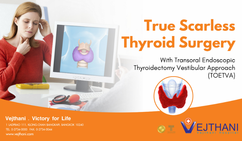 True Scarless Thyroid Surgery